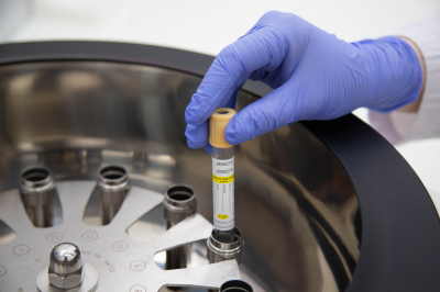 Врач Барсуков рассказал, как правильно сдавать анализ на уровень холестерина